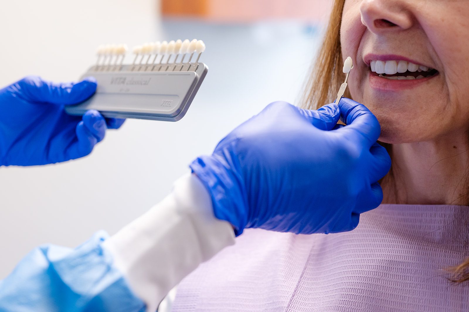 A professional shade guide held next to a patient's smile during in-office whitening